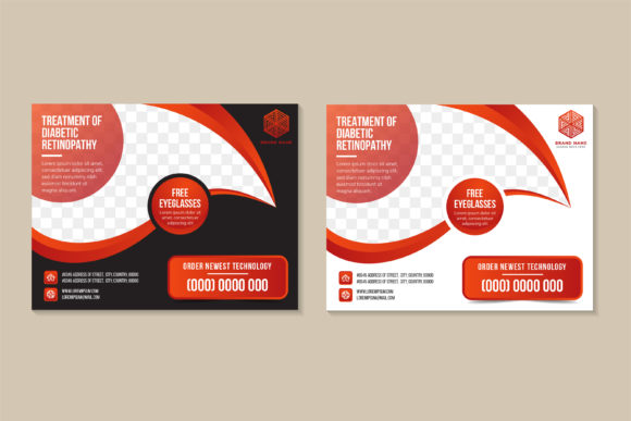 Treatment of Diabetic Retinophaty Horizo: Graphics and Print Templates